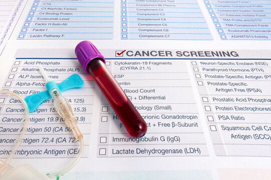 Blood test sample for Tumor markers test for diagnosis cancer. Blood analysis with request form for screening of test for Malignancy oncology cancer cells investigation in patient