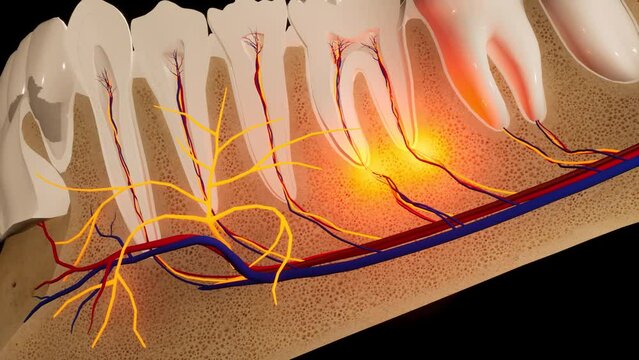 Toothache. Anatomical detailed section of the teeth. Nerve inflammation. 3D animation