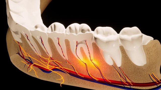 Toothache. Anatomical detailed section of the teeth. Nerve inflammation. 3D animation
