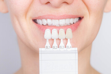 Perfect white smile with shade guide bleach color tooth dental whitening, bleaching, quality...