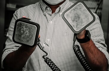 A health care worker holding paddles of a defibrillator . Defibrillator has two paddles to deliver shock called apex paddle and sternum paddle.. - obrazy, fototapety, plakaty