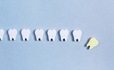 Teeth loss. Sick fallen tooth with cavity among healthy ones. Bad eating habits, poor oral hygiene,...