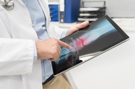 Doctor examine an x-ray image of a patient in digital tablet at doctor office. High quality photography.