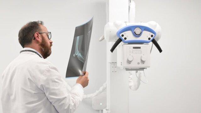 Doctor examine a film x-ray of a patient at radiology room. High quality 4k footage