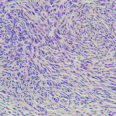 Camera photo of normal ovarian stroma, magnification 400x, photograph through a microscope