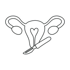 Gynecological surgery, problem with reproductive system. Gynecology. Uterine, ovaries and scalpel. 