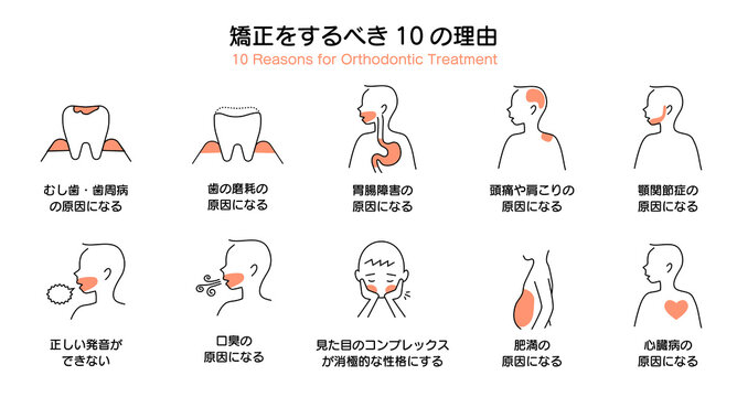 歯科矯正をするべき10の理由