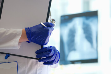 Doctor is holding clipboard and pen in background of x-ray of lungs