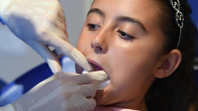 Dentist applying fluorine paste to young girl teeth during dental cleaning. Slow motion