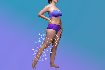 Leg liposuction, fat and cellulite removal concept, overweight female body with painted surgical lines and arrows - obrazy, fototapety, plakaty