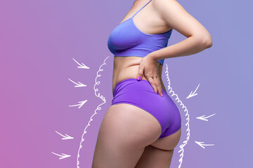 Buttocks, hip, abdomen liposuction, fat and cellulite removal concept, overweight female body with painted surgical lines and arrows - obrazy, fototapety, plakaty