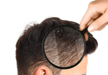 Looking at young man's hair through magnifier on white background. Problem of dandruff