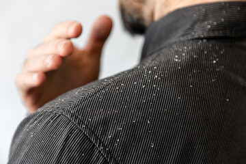 A bearded man in a black shirt shakes dandruff of his shoulder. Close-up. The concept of psoriasis and seborrheic dermatitis - obrazy, fototapety, plakaty