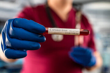 Male doctor wear red uniform, gloves from virus disease examines blood in a test tube