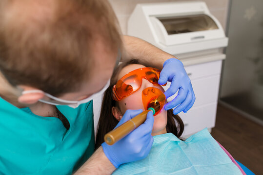 A female patient in dental glasses treats teeth at the dentist with ultraviolet light. dental fillings.