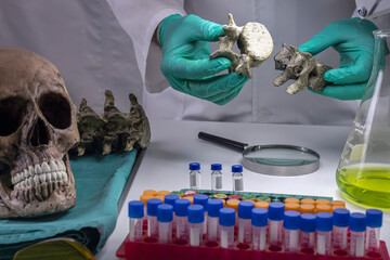 Forensic scientist comparing two human vertebrae of adult male homicide victims to extract DNA,...
