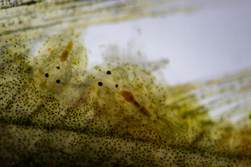 Parasitic (Argulus sp.), Study of Argulus sp. under microscope view in laboratory.
