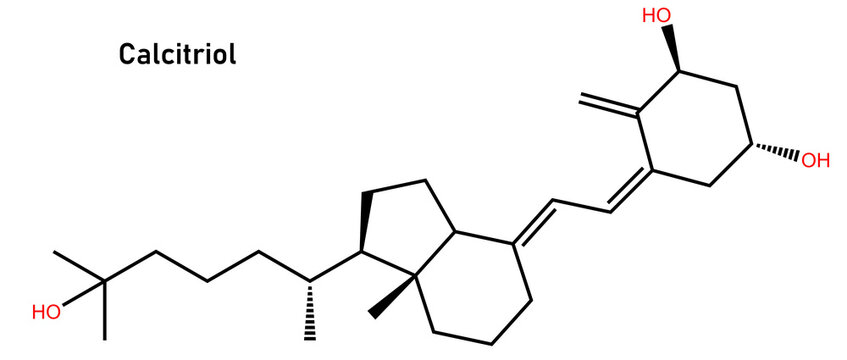 Calcitriol is a synthetic version of Vitamin D3 used to treat calcium deficiency with hypoparathyroidism (decreased functioning of the parathyroid glands) and metabolic bone disease