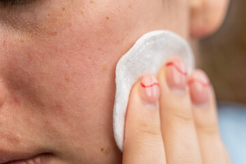 Naklejka premium girl rubbing lotion on her face with a cotton pad