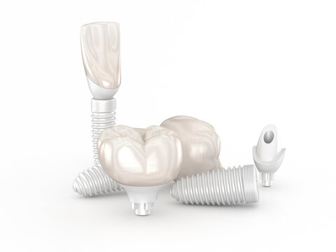 Dental Implants made form ceramic. Dental 3D illustration