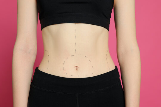Slim woman with marks on body against pink background, closeup. Weight loss surgery
