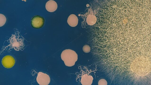 experiment growing microorganisms that decompose plastic in a microbiological laboratory