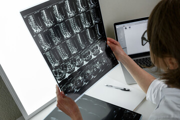 Doctor examining the result of lower spine MRI - 502459373