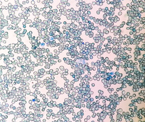Microscopic view of abnormal reticulocyte count in hematology department, methylene blue staining