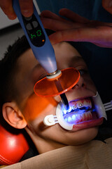 Alignment of crooked teeth with the help of braces, installation of braces for a child, an...