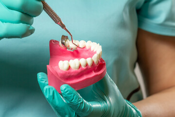 Dentist's hands with layout of the human jaw and dental instrument.