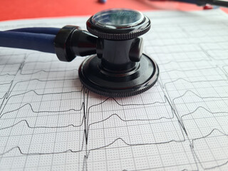 Stethoscope with cardiogram on white background. Heart diagnosis