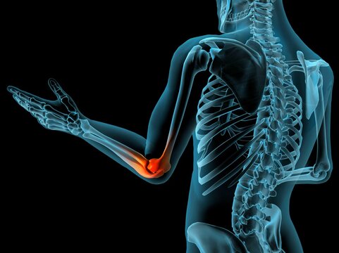 X-ray view of elbow joint with red inflammation in a see-through arm with hand and spinal bones