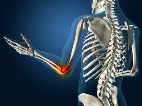 X-ray view of elbow joint red with inflammation in a see-through arm with hand and spinal bones