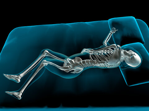 X-ray view of a woman sleeping
