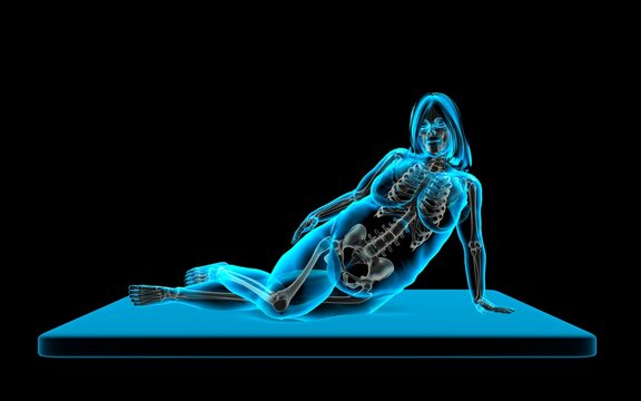 Rubenesque nude woman reclining on side, X-ray image
