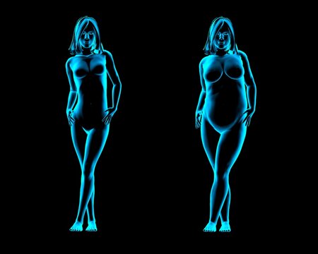 Obese and thin women posing in catwalk style, X-ray image