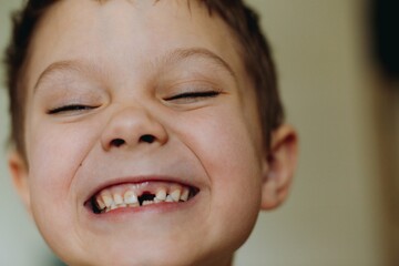 close up portrait of cute caucasian 6 year old boy with lost front tooth
