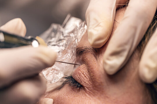 Nonsurgical cosmetic procedures