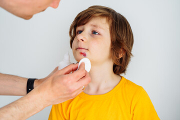 Dad doctor father treats bruised wound on his son school boy kid face. Man cleans addresses the...