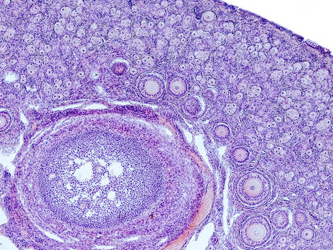rabbit ovary cross section under the microscope showing tunica albuginea, primordial follicles, primary follicles, secondary follicles and cortical stroma - optical microscope x100 magnification