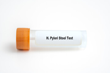 H. Pylori Stool Test