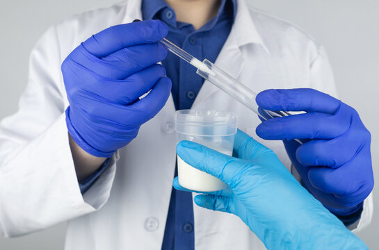Medical laboratory assistant checks a test tube with sperm. Spermogram. Male fertility test. Semen in a test tube. Reproductive system check. Donor suitability test for artificial insemination