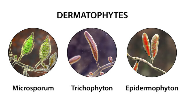 Dermatophyte fungi, 3D illustration