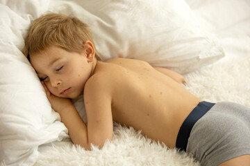 Toddler boy with chicken pox,lying in bed with fever, mother checking him