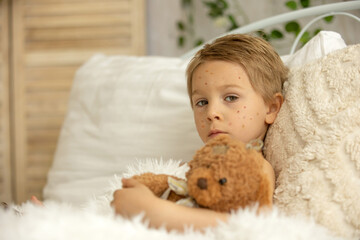 Toddler boy with chicken pox,lying in bed with fever, mother checking him
