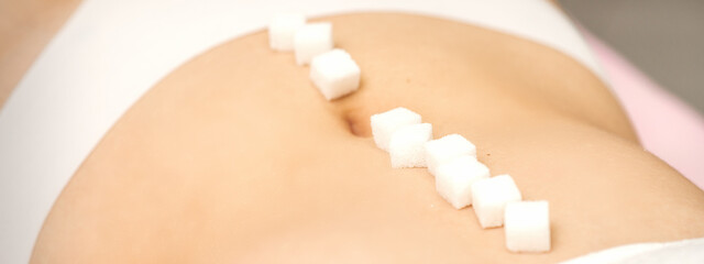 The concept of epilation, waxing. Sugar cubes lying in a row on the abdomen of a young white woman, close up