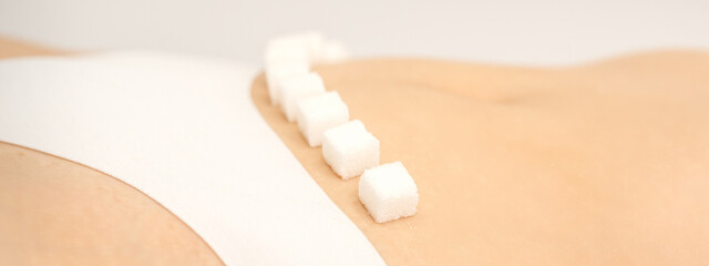 The concept of epilation, waxing, and intimate hygiene. Sugar cubes lying in a row on the bikini zone of a young white woman, close up