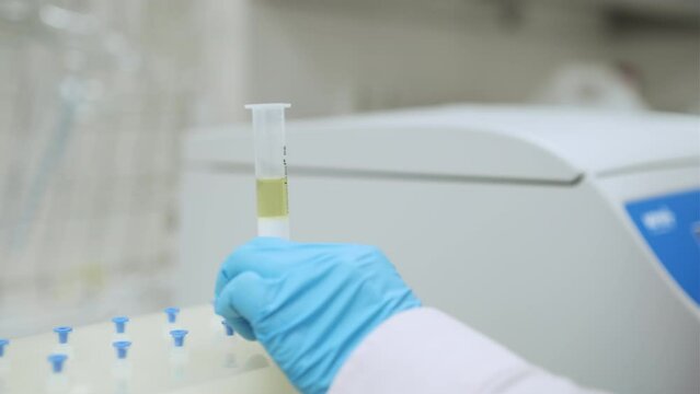 Scientist purifies extract using Vaccum SPE manifold. Solid phase extraction for food and plant analysis.