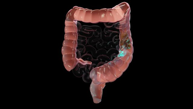 Anatomy of the human digestive system, concept of the intestine, alpha channel, laxative, traitement of constipation, 3d render