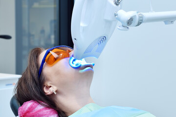 Laser bleaching teeth in modern clinic.